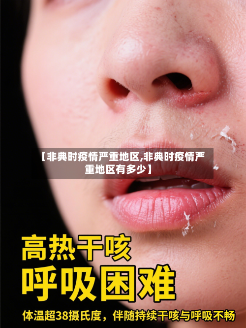 【非典时疫情严重地区,非典时疫情严重地区有多少】